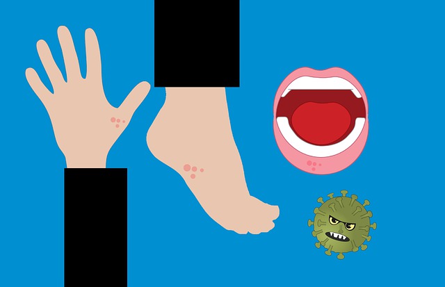 수족구병에 대한 다양한 정보를 담은 글의 썸네일 사진