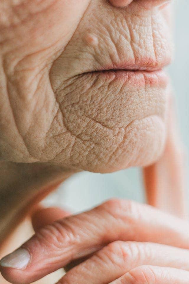 피부 노화에 대해 설명하는 글의 썸네일 사진