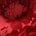 이상지질혈증: 건강한 심혈관을 위한 예방과 관리 6