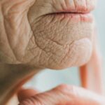 베개 자국 오래가면 피부 노화의 신호?? 3