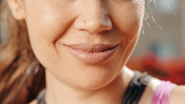 입술 포다이스 반에 대해 설명하는 글의 썸네일 사진